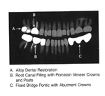 Dental alloy