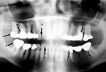Dental overview