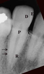 Tooth anatomy