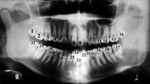 Tooth numbering system