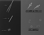 Surgical clips