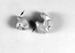 Hearing aid