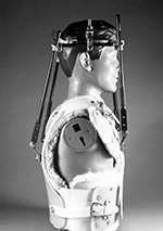 Halo vest and brace lateral view