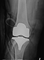 Figure 10A