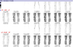 Figure 12A
