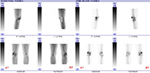 Figure 12B