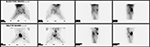 Figure 14B