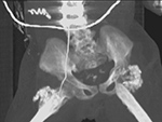 Figure14E
