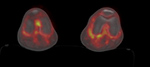 Figure 17F