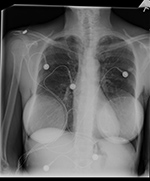 Figure 18B