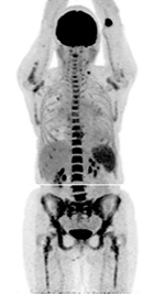 Figure 22