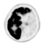 Figure 23B
