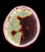 Figure 23C