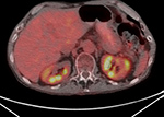 Figure 25F
