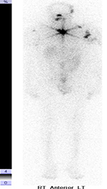 Figure 26B