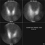 Figure 29