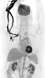 Figure 30E