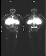 Figure 32B