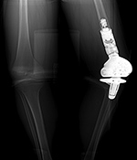 Figure 4A